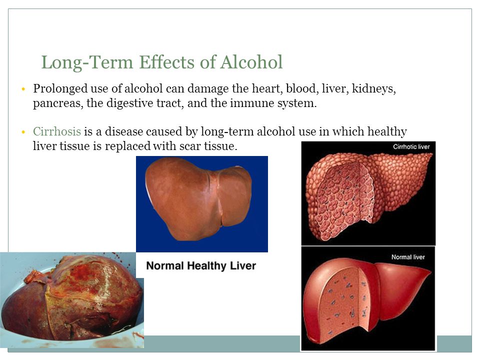 Alocohol. Bellringer What Impact Would It Have If Every Alcohol 