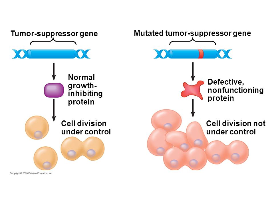 Mutated tumor-suppressor gene Tumor-suppressor gene Defective, nonfunctioning protein Normal growth- inhibiting protein Cell division under control Cell division not under control