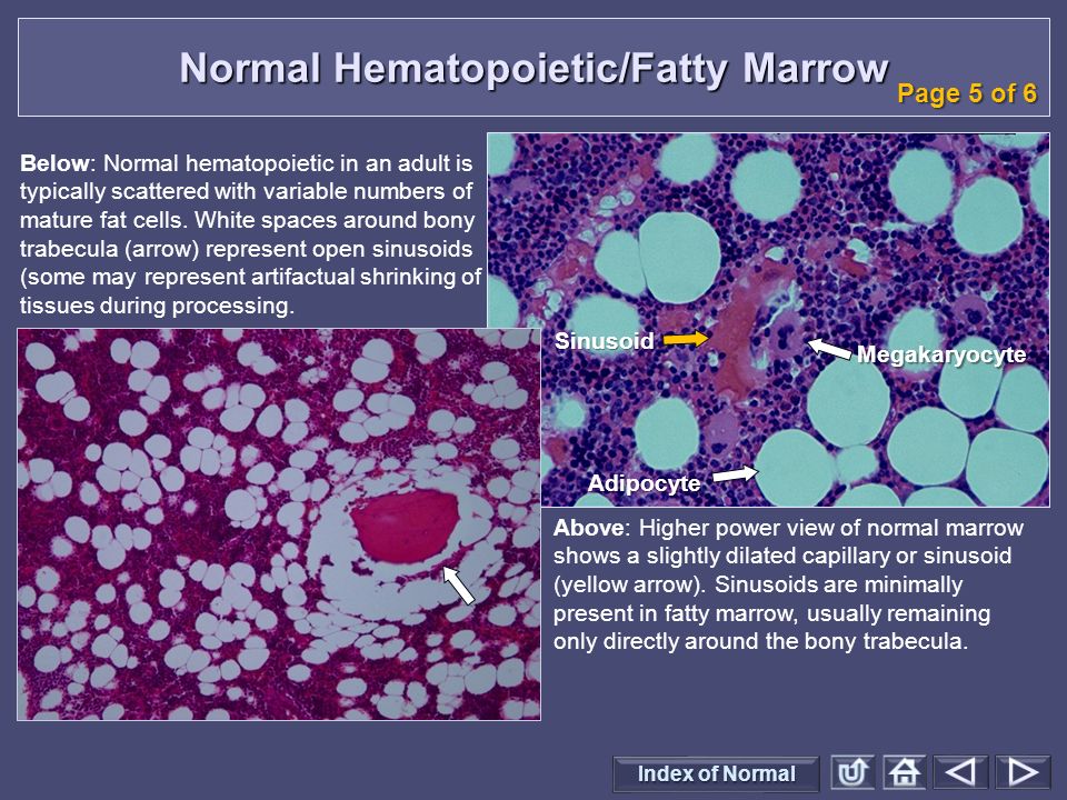Are not mature adipocytes fibrovascular trabeculae talk Consider, mature adipocytes fibrovascular trabeculae