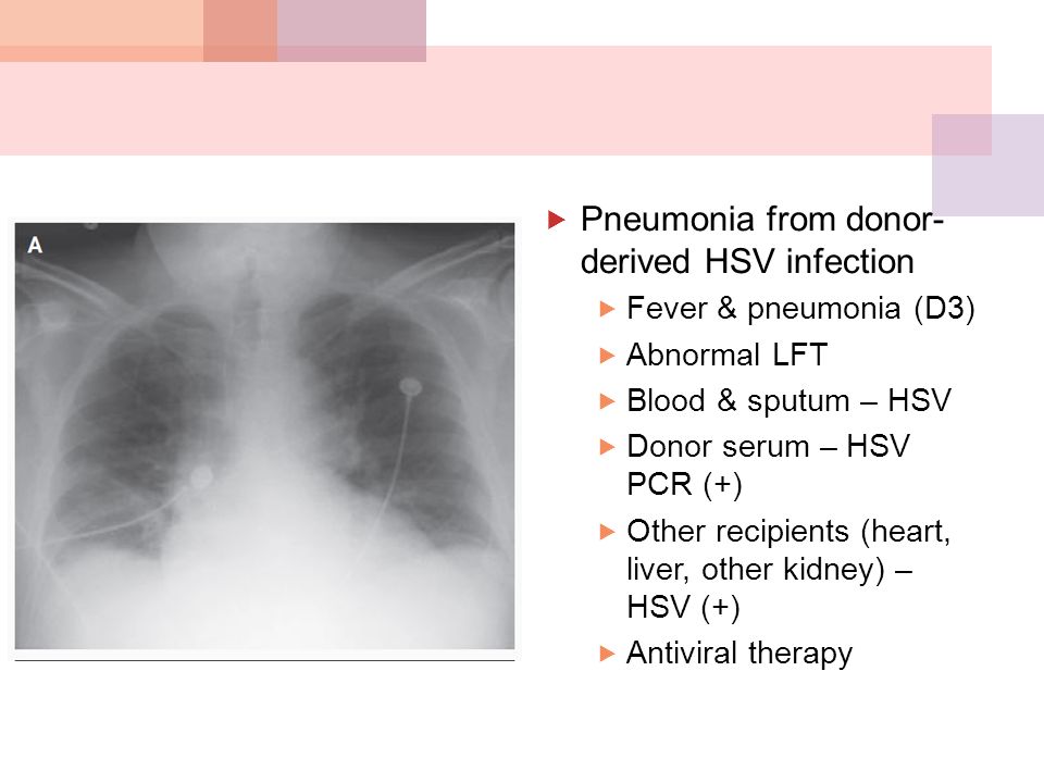 Pneumonia from donor- derived HSV infection  Fever & pneumonia (D3)  Abnormal LFT  Blood & sputum – HSV  Donor serum – HSV PCR (+)  Other recipients (heart, liver, other kidney) – HSV (+)  Antiviral therapy