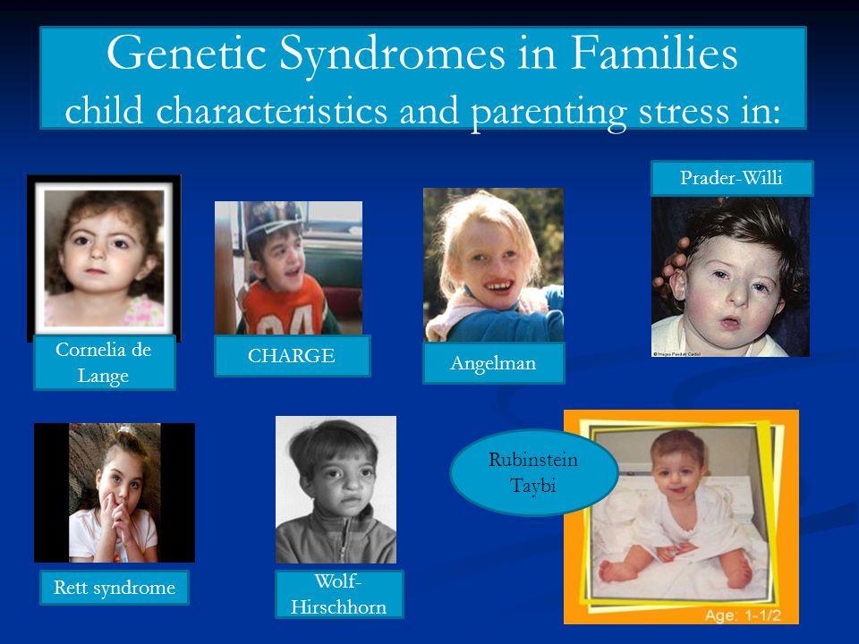Rubinstein-Taybi Syndrome: Behavior