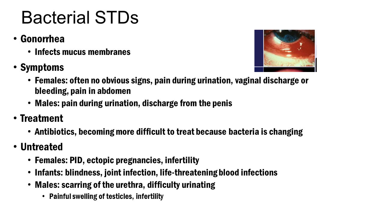 mucous discharge penis Mucous discharge penis