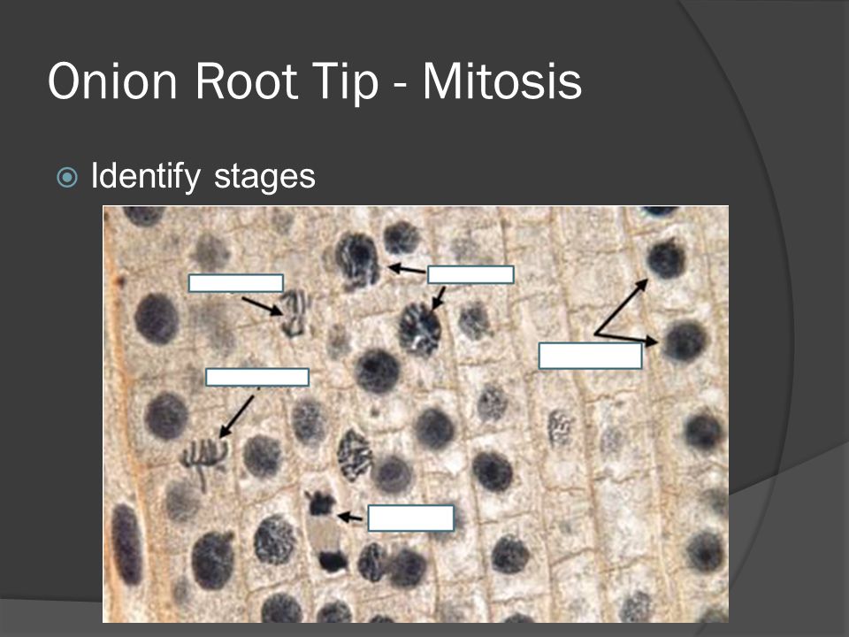 Onion Root Tip - Mitosis  Identify stages