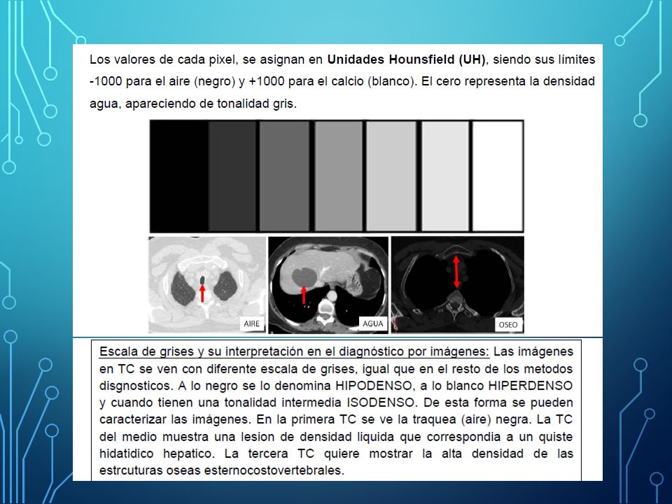 Equipo de tomografía y métodos de reconstrucción - ppt video online download
