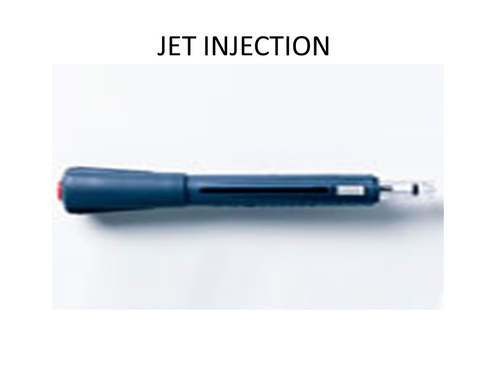 JET INJECTION