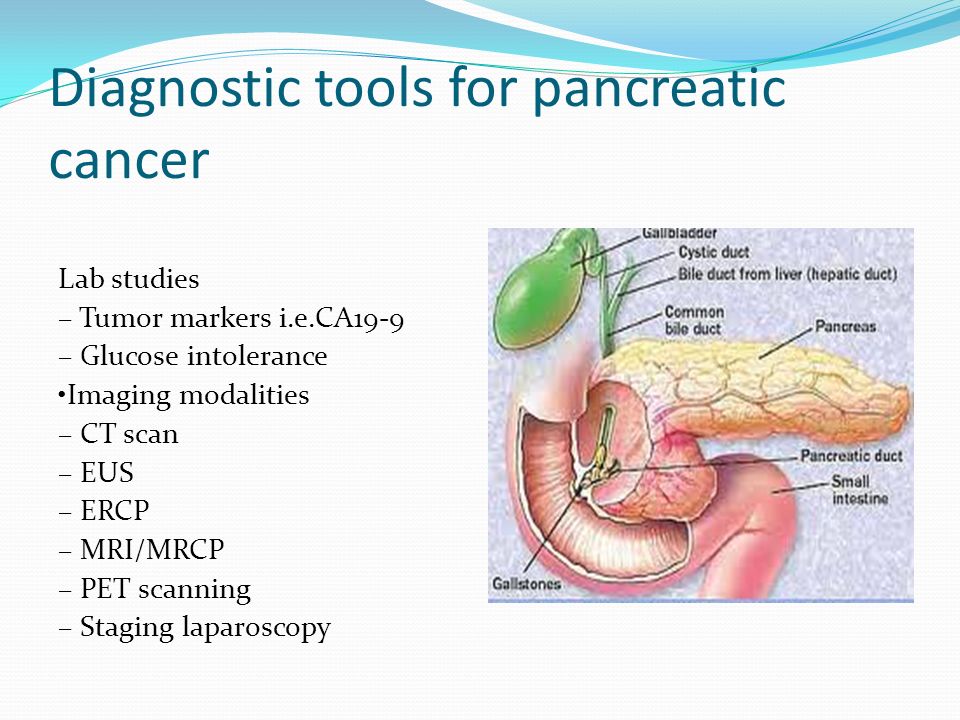 Cancer de pancreas curado