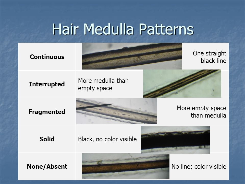 Hair Evidence Notes on Provided Notes Page. The Biology of Hair. - ppt  download