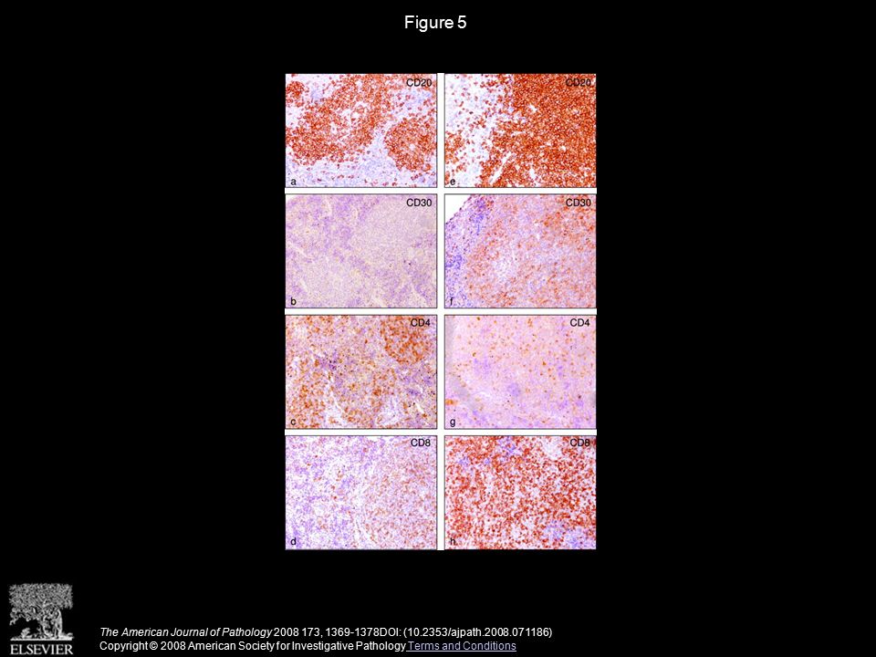 Figure 5 The American Journal of Pathology , DOI: ( /ajpath ) Copyright © 2008 American Society for Investigative Pathology Terms and Conditions Terms and Conditions