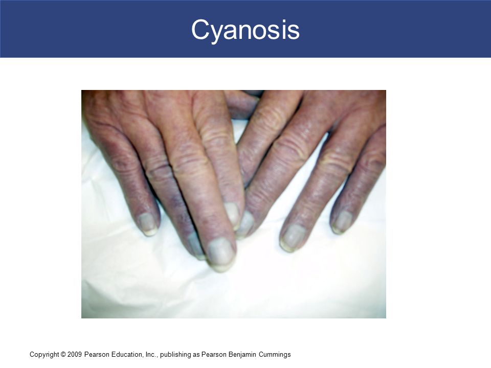 5 The Integumentary System. PSR #3 Cut- [skin] Derm- [skin] Epi- [upon ...