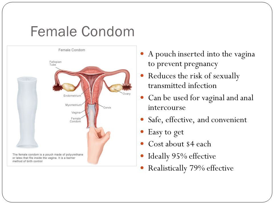 The Annovera Contraceptive Vaginal Ring Is Fda