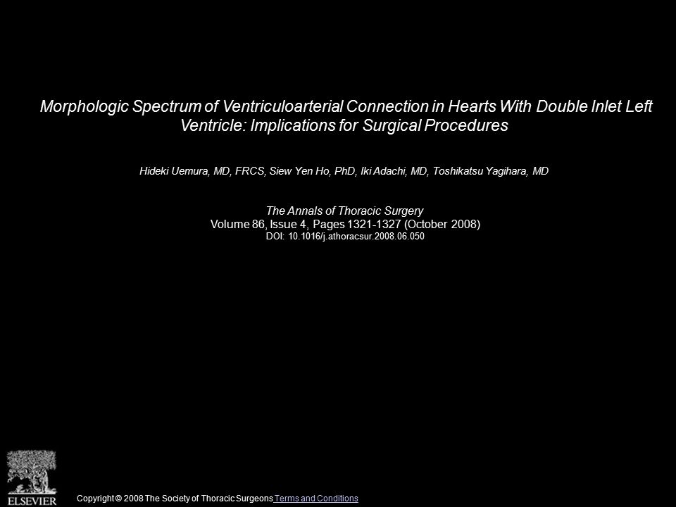 Morphologic Spectrum of Ventriculoarterial Connection in Hearts With Double Inlet Left Ventricle: Implications for Surgical Procedures Hideki Uemura, MD, FRCS, Siew Yen Ho, PhD, Iki Adachi, MD, Toshikatsu Yagihara, MD The Annals of Thoracic Surgery Volume 86, Issue 4, Pages (October 2008) DOI: /j.athoracsur Copyright © 2008 The Society of Thoracic Surgeons Terms and Conditions Terms and Conditions