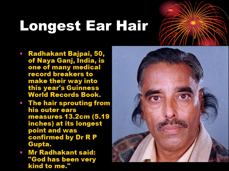After Samantha Ruth Prabhu's 'hair growing from ears' jibe, producer hits  back - Hindustan Times