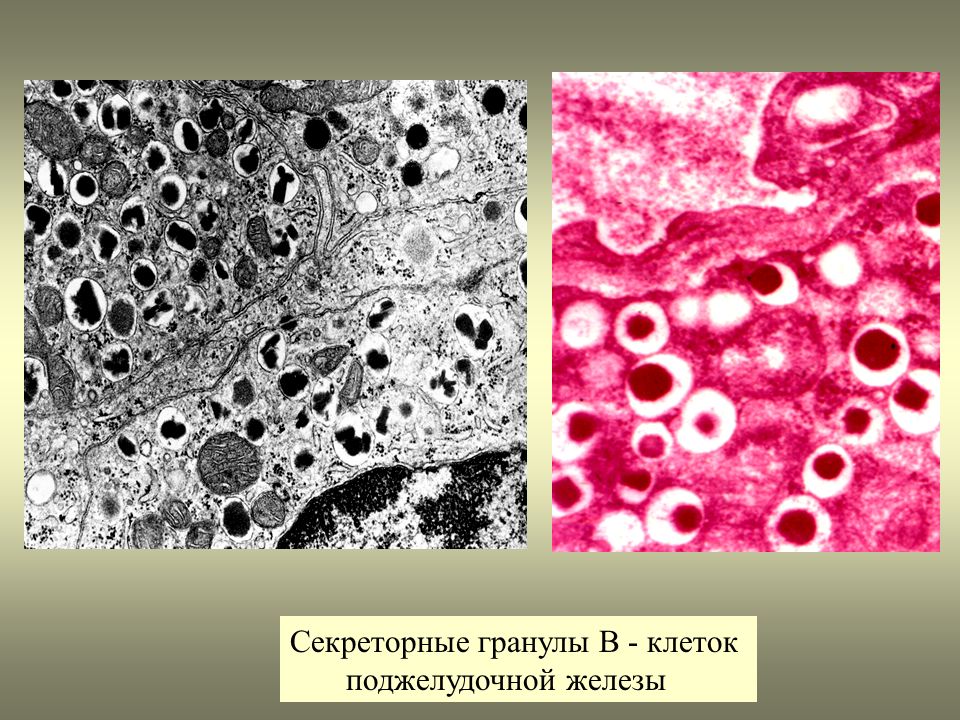 Секреторные б клетки. Секреторные гранулы в клетках Лейдига. Секреторные гранулы в клетках Лейдига кожи аксолотля препарат. Клетки Лейдига кожи аксолотля. Секреторные гранулы гистология.