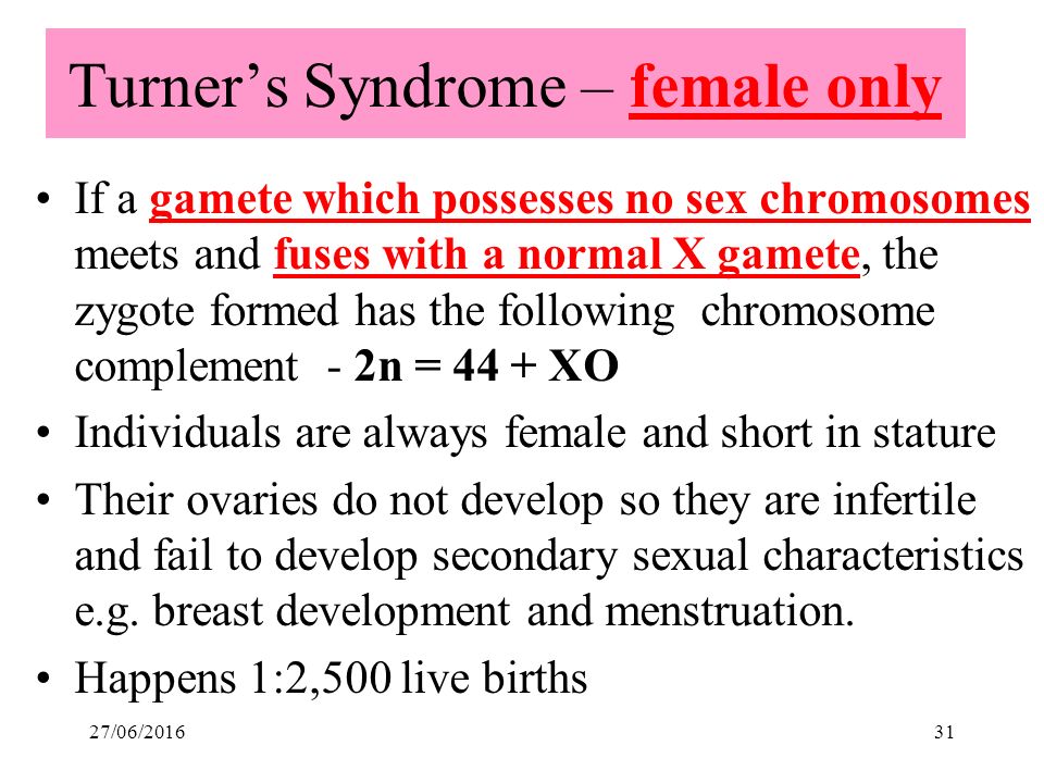 Turner’s Syndrome – female only If a gamete which possesses no sex chromosomes meets and fuses with a normal X gamete, the zygote formed has the following chromosome complement - 2n = 44 + XO Individuals are always female and short in stature Their ovaries do not develop so they are infertile and fail to develop secondary sexual characteristics e.g.