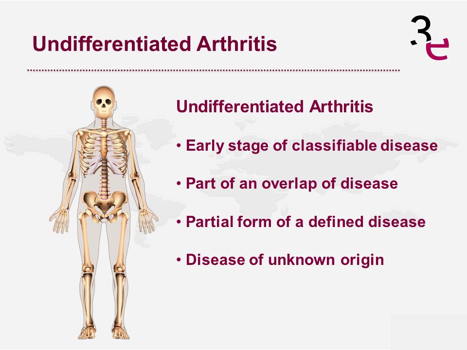 Undifferentiated Arthritis Early stage of classifiable disease Part of an overlap of disease Partial form of a defined disease Disease of unknown origin