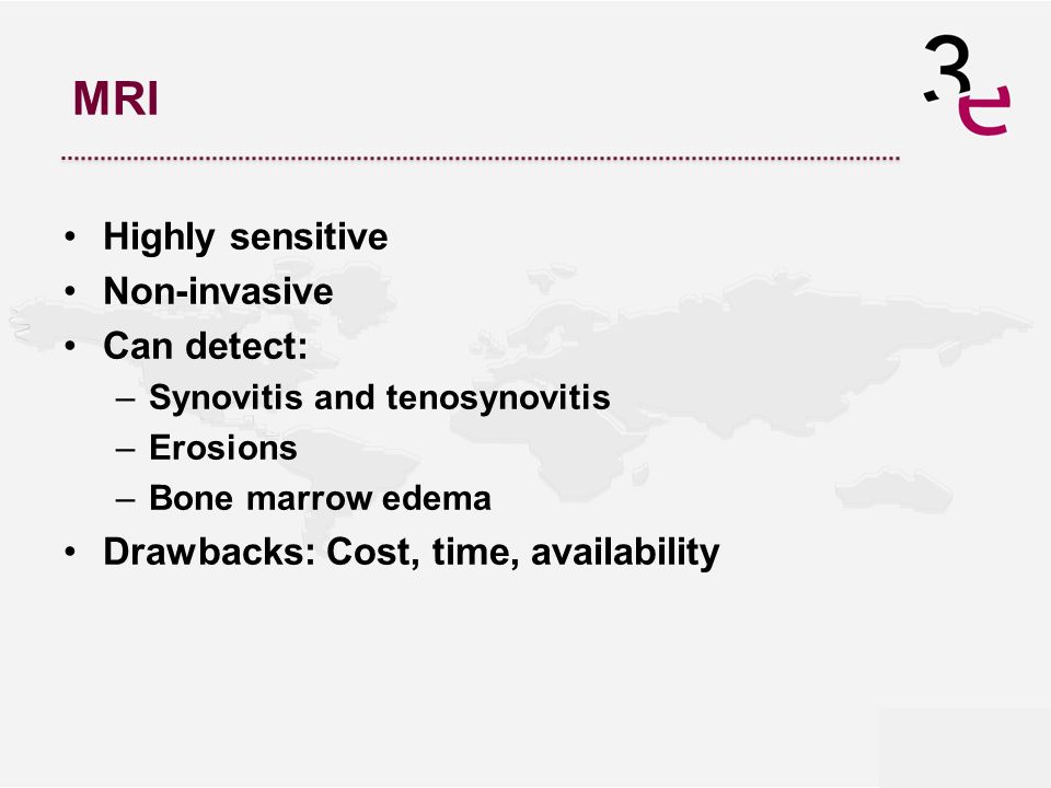 MRI Highly sensitive Non-invasive Can detect: –Synovitis and tenosynovitis –Erosions –Bone marrow edema Drawbacks: Cost, time, availability