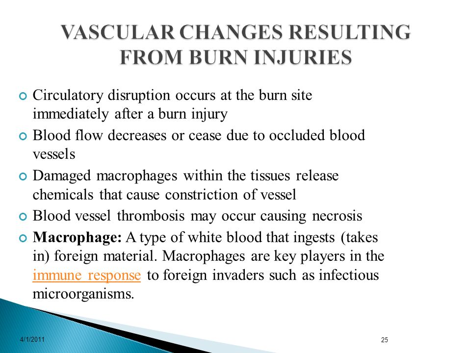 Circulatory disruption occurs at the burn site immediately after a burn injury Blood flow decreases or cease due to occluded blood vessels Damaged macrophages within the tissues release chemicals that cause constriction of vessel Blood vessel thrombosis may occur causing necrosis Macrophage: A type of white blood that ingests (takes in) foreign material.