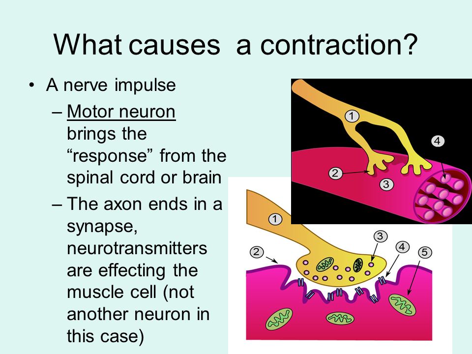 What causes a contraction.