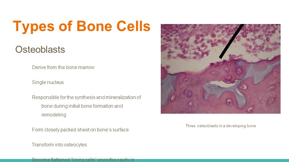 Types of Bone Cells Osteoblasts Derive from the bone marrow Single nucleus Responsible for the synthesis and mineralization of bone during initial bone formation and remodeling Form closely packed sheet on bone’s surface Transform into osteocytes Become flattened lining cells once the cavity is filled Three osteoblasts in a developing bone