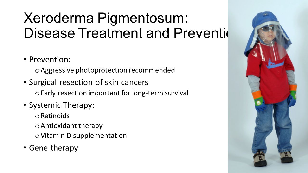 Xeroderma Pigmentosum An Insight Into Dna Repair Processes