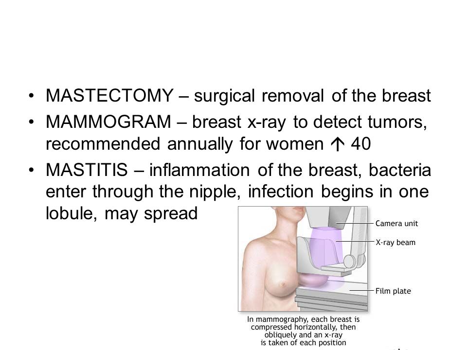 MASTECTOMY - surgical removal of the breast MAMMOGRAM - breast x-ray to det...