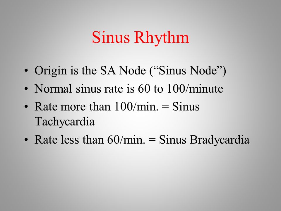 Sinus Rhythm Origin is the SA Node ( Sinus Node ) Normal sinus rate is 60 to 100/minute Rate more than 100/min.