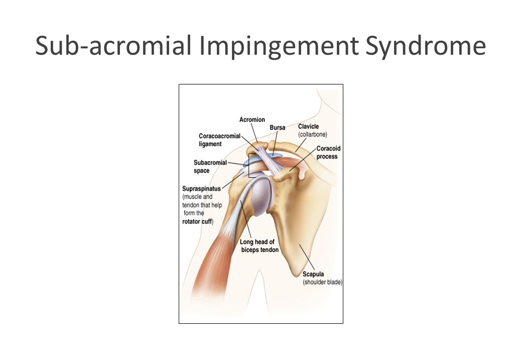 the shoulder assessment and management of common shoulder problems