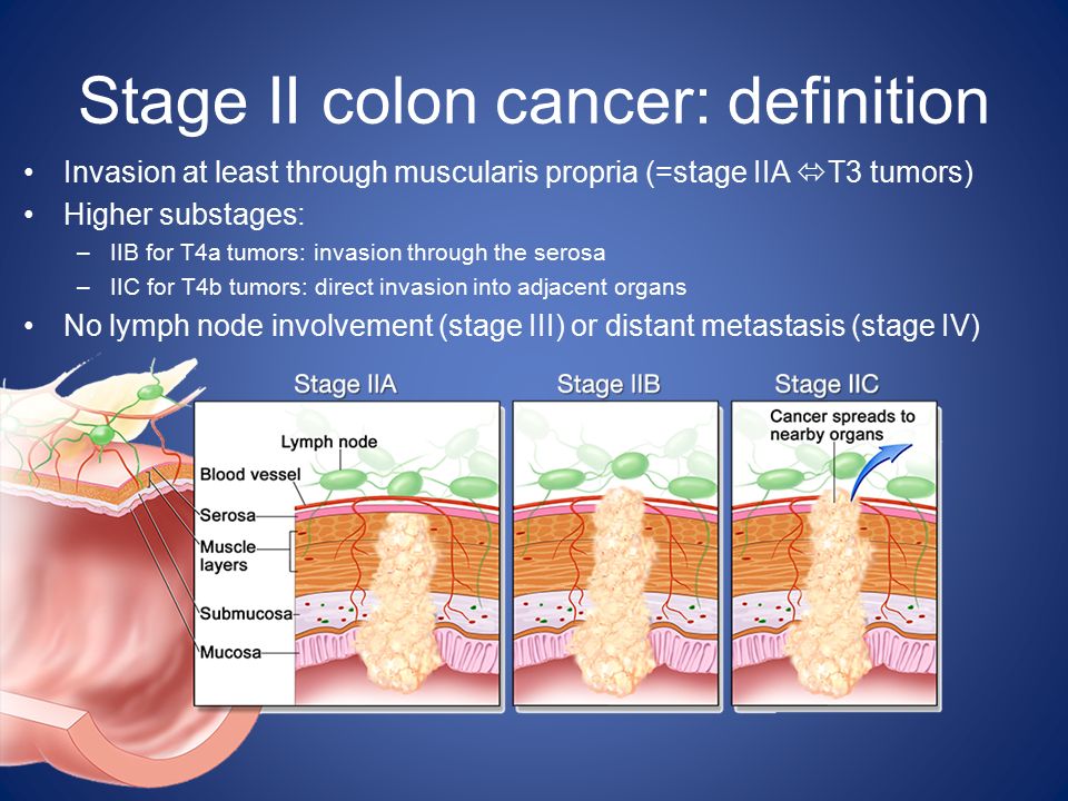 Stages of cancer. Risk Factors of Colon Cancer. Colon Cancer Definition Symptoms treatment.