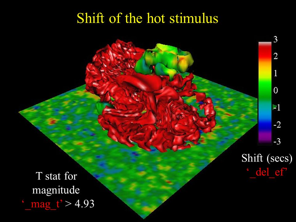 Shift (secs) ‘_del_ef’ Shift of the hot stimulus T stat for magnitude ‘_mag_t’ > 4.93