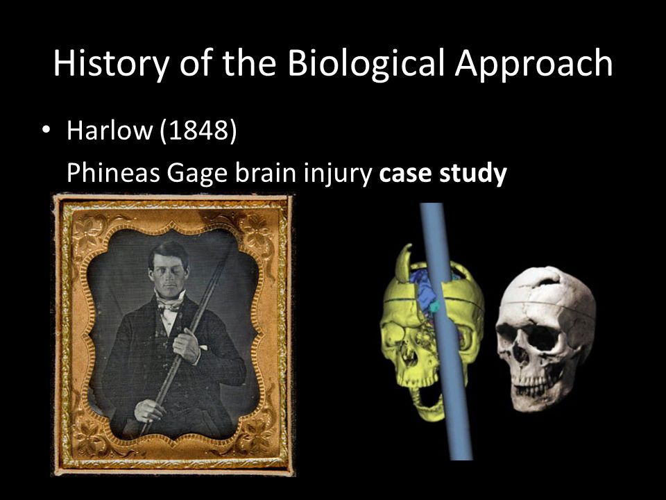 harlow phineas gage case study