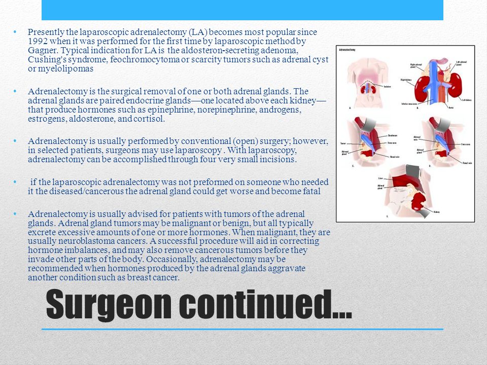 The Endocrine system Abby Asselborn, Cameron Boden, Leah Hearn, Joshua ...