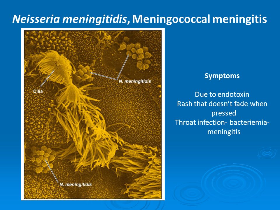 Neisseria meningitidis, Meningococcal meningitis Symptoms Due to endotoxin Rash that doesn’t fade when pressed Throat infection- bacteriemia- meningitis
