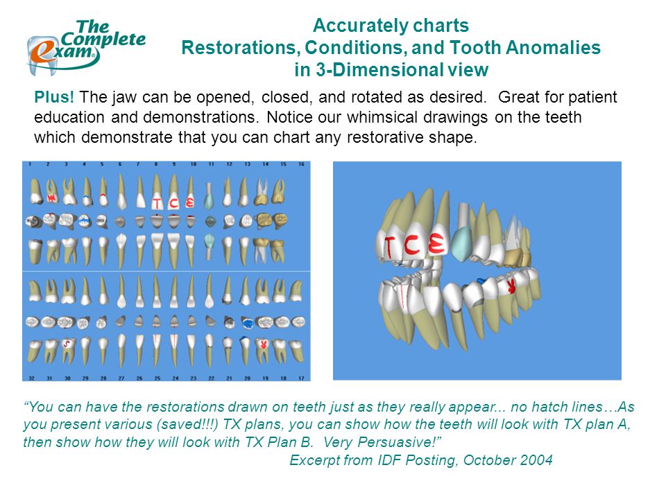Charting Teeth Practice