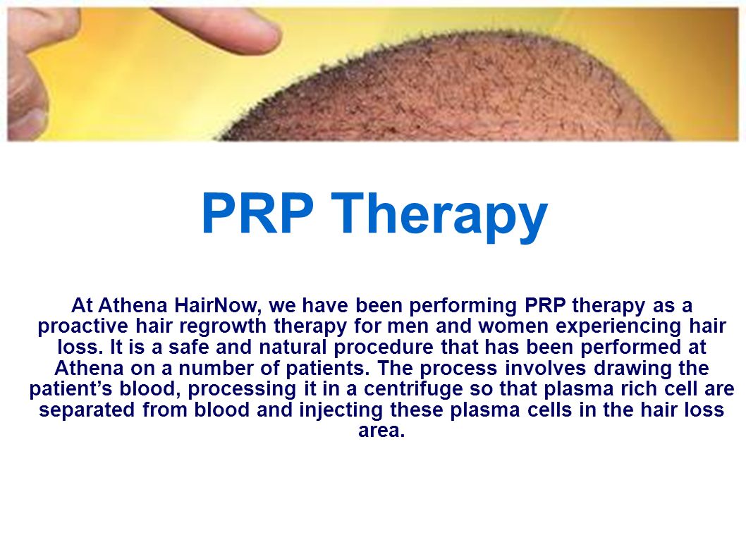 PRP Therapy At Athena HairNow, we have been performing PRP therapy as a proactive hair regrowth therapy for men and women experiencing hair loss.