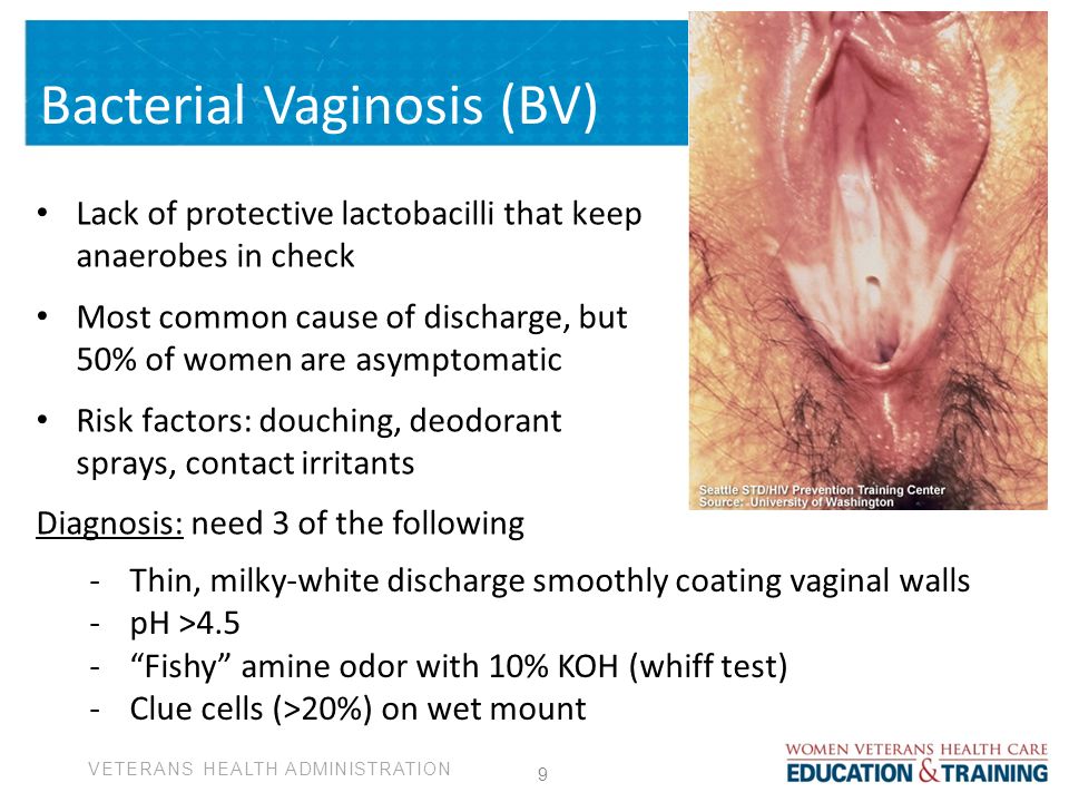 Bacterial Vaginosis Needs New Treatment Approaches Monash Lens