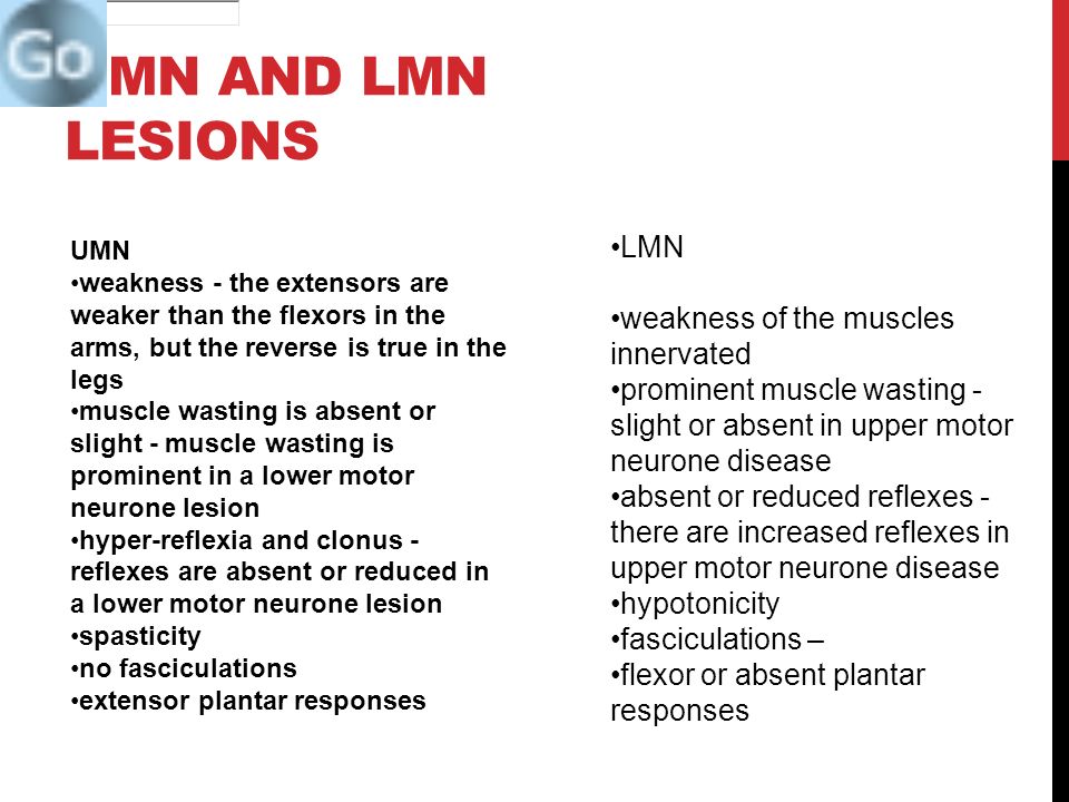 Quick Neuro Quiz Parkinsons Name 4 Signs Umn And Lmn Lesions Name 4 Differences Ppt Download