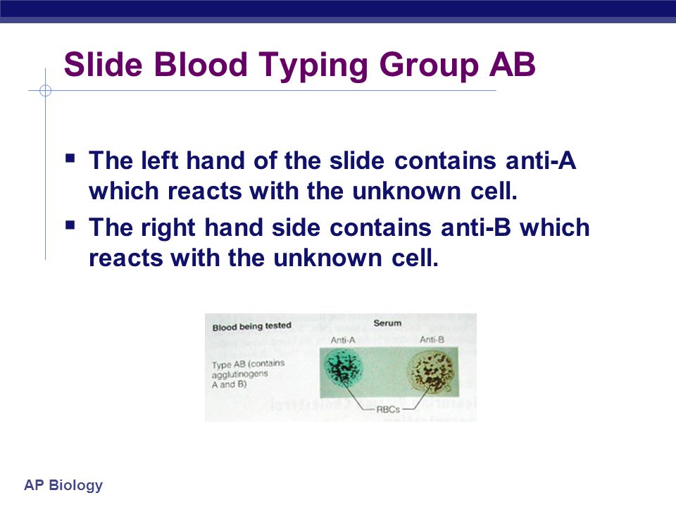 AP Biology Slide Blood Typing Group O  The left hand of the slide contains anti-A does not react with the unknown cell.