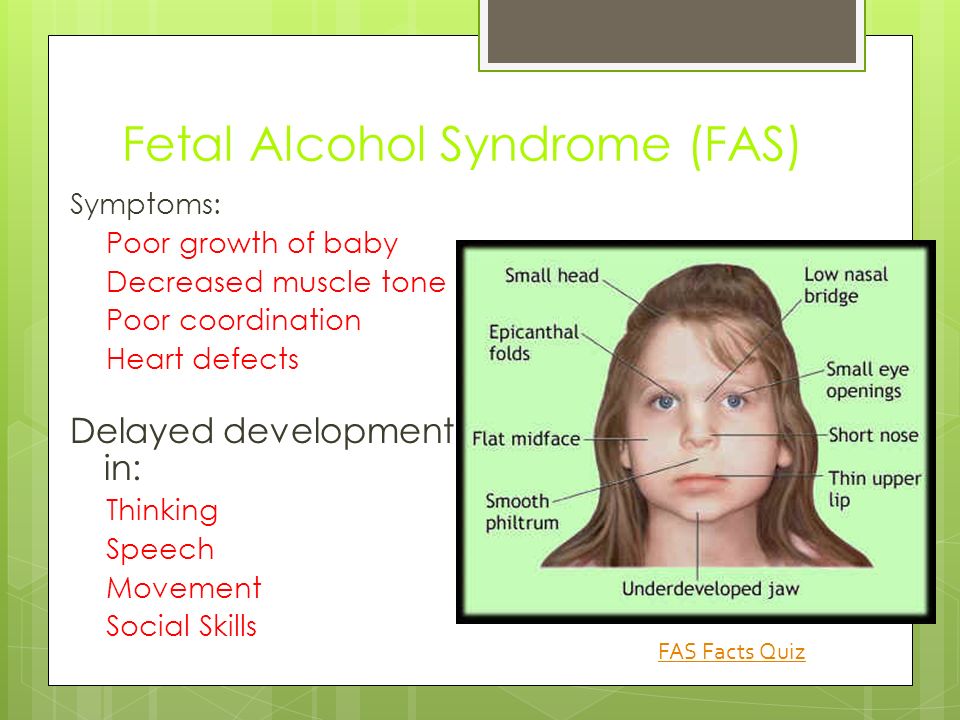 Prenatal Care and Birth Defects Objectives: TSWBAT - Understand ...