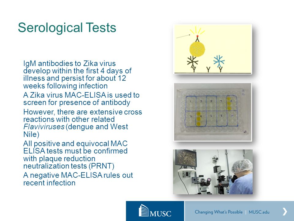 Serological Tests IgM antibodies to Zika virus develop within the first 4 days of illness and persist for about 12 weeks following infection A Zika virus MAC-ELISA is used to screen for presence of antibody However, there are extensive cross reactions with other related Flaviviruses (dengue and West Nile) All positive and equivocal MAC ELISA tests must be confirmed with plaque reduction neutralization tests (PRNT) A negative MAC-ELISA rules out recent infection