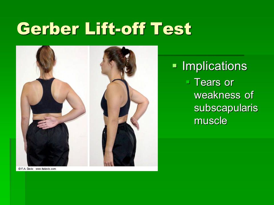 Ch. 13 – The Shoulder and Upper Arm Review of Special Tests. - ppt download
