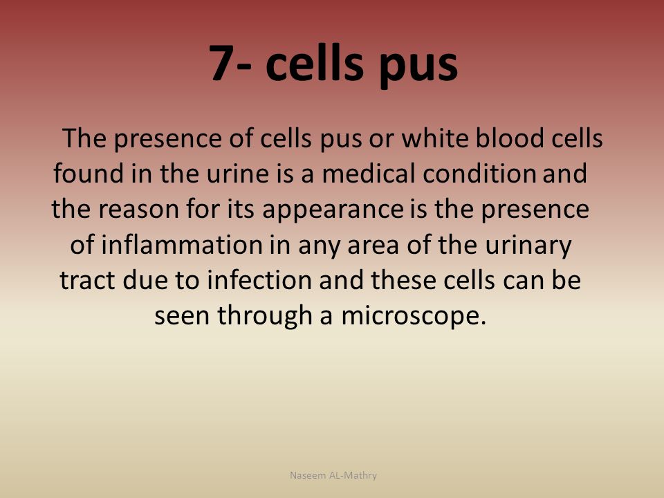 7- cells pus The presence of cells pus or white blood cells found in the urine is a medical condition and the reason for its appearance is the presence of inflammation in any area of the urinary tract due to infection and these cells can be seen through a microscope.