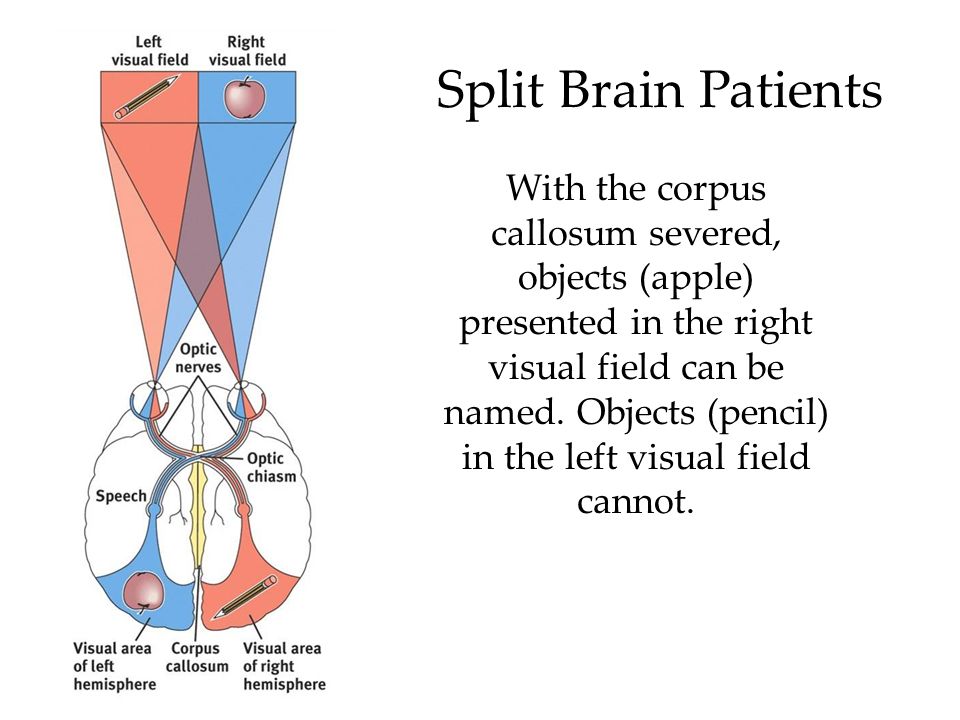 Split brain. Split Brain problem. Split-Brain в стекируемых коммутаторах.