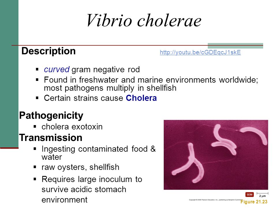 vibrio cholerae ppt Vibrio mahadi ppt.