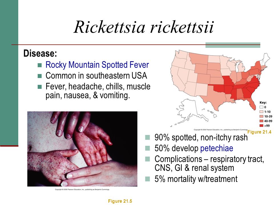 Rickettsia rickettsii Disease: Rocky Mountain Spotted Fever Common in southeastern USA Fever, headache, chills, muscle pain, nausea, & vomiting.