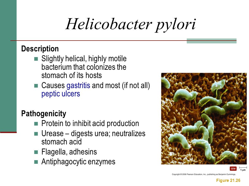 Helicobacter pylori Description Slightly helical, highly motile bacterium that colonizes the stomach of its hosts Causes gastritis and most (if not all) peptic ulcers Pathogenicity Protein to inhibit acid production Urease – digests urea; neutralizes stomach acid Flagella, adhesins Antiphagocytic enzymes Figure 21.26