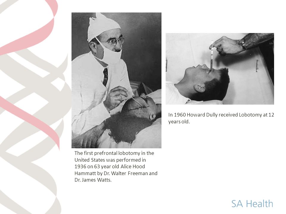 The first prefrontal lobotomy in the United States was performed in 1936 on 63 year old Alice Hood Hammatt by Dr.