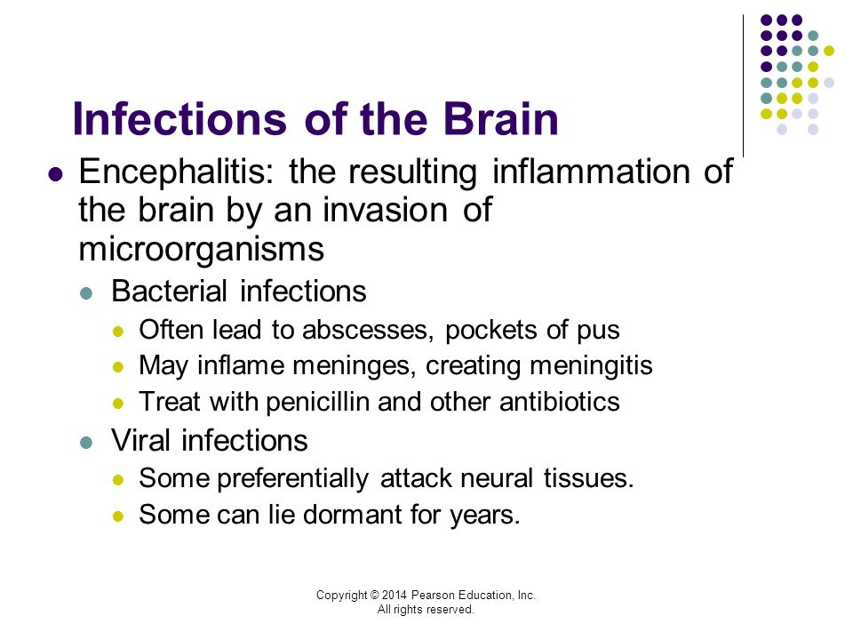 Infections of the Brain Encephalitis: the resulting inflammation of the brain by an invasion of microorganisms Bacterial infections Often lead to abscesses, pockets of pus May inflame meninges, creating meningitis Treat with penicillin and other antibiotics Viral infections Some preferentially attack neural tissues.