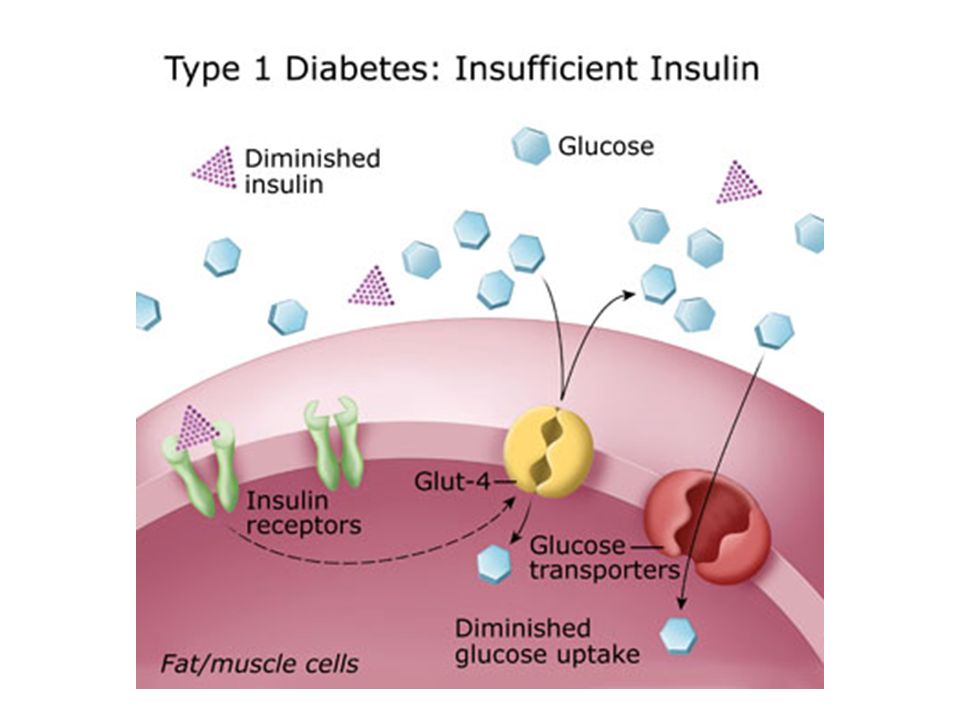 Vitaminas para la resistencia a la insulina