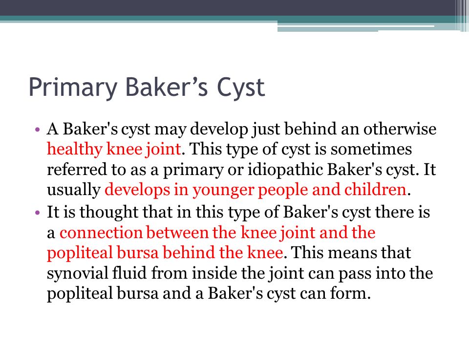 Primary Bakers Cyst A Baker S Cyst May Develop Just Behind An Otherwise Healthy Knee Joint Primary Bakers Cyst A Baker S Cyst May Develop Just Behind An Otherwise Healthy Knee Joint
