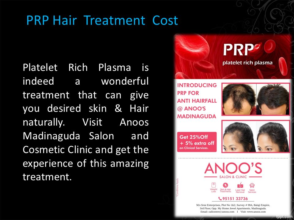 Platelet Rich Plasma Therapy (PRP) Treatment. About Us Platelet Rich Plasma  Therapy (PRP) – Non Surgical Hair Loss Treatment In Anoosmadinaguda. PRP  therapy. - ppt download
